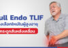 Full Endo TLIF ทางเลือกใหม่ในการผ่าตัดกระดูกสันหลังเคลื่อนใน “ผู้สูงอายุ”