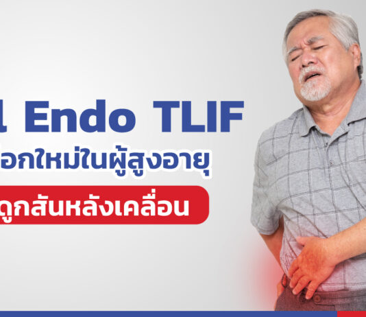 Full Endo TLIF ทางเลือกใหม่ในการผ่าตัดกระดูกสันหลังเคลื่อนใน “ผู้สูงอายุ”
