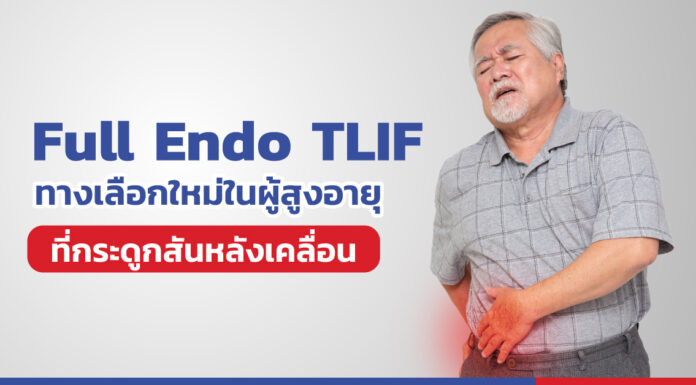 Full Endo TLIF ทางเลือกใหม่ในการผ่าตัดกระดูกสันหลังเคลื่อนใน “ผู้สูงอายุ”